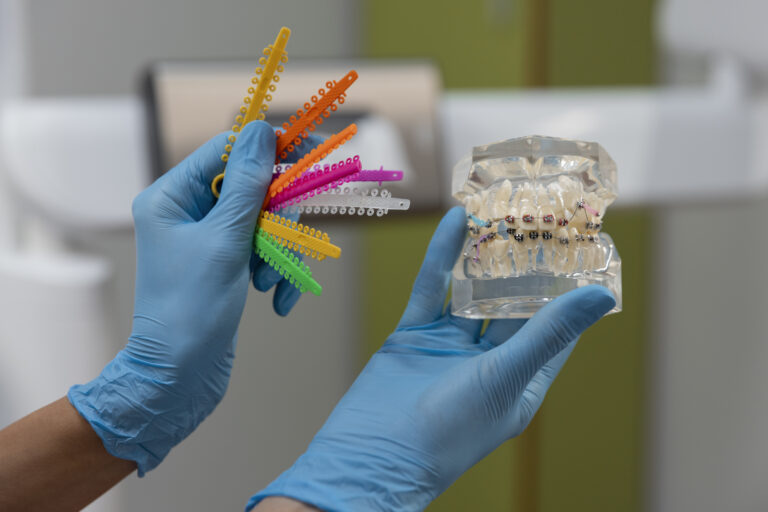 Ręce w niebieskich rękawiczkach lateksowych trzymają model szczęki z aparatem ortodontycznym oraz zestaw kolorowych ligatur do zamków