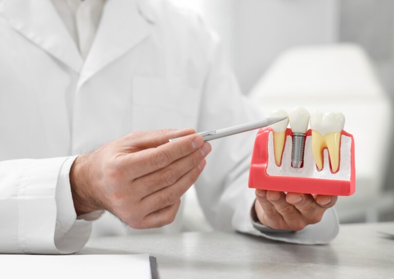 Lekarz w białym fartuchu pokazuje model szczęki z implantem dentystycznym, wskazując go długopisem.