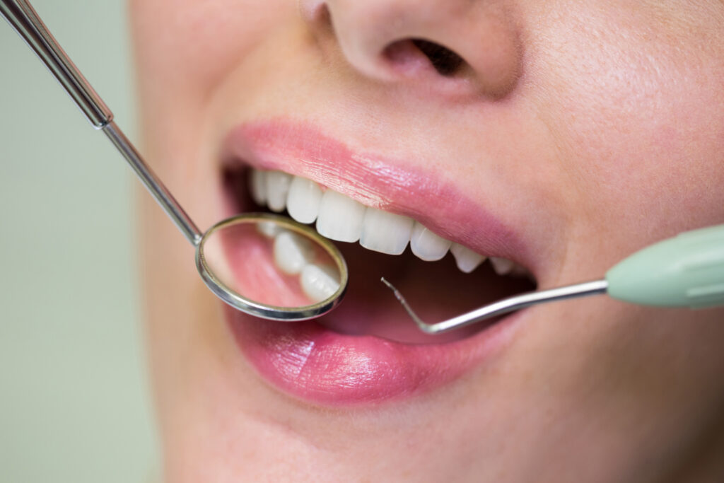 Dentist examining a patient at SW11 Medical and Dental Clinic in Clapham
